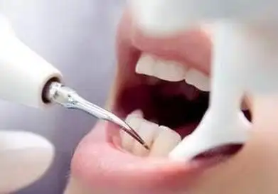 洗牙会不会损害到牙齿