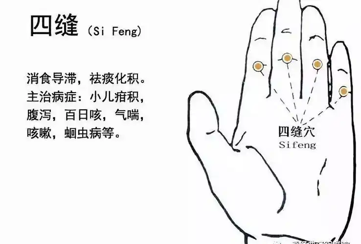 四缝穴扎一次见效二次痊愈真是绝了