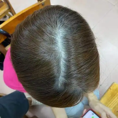 家人们我想问下这个发缝正常吗