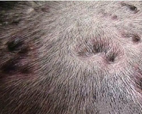 头皮癣早期症状图片5