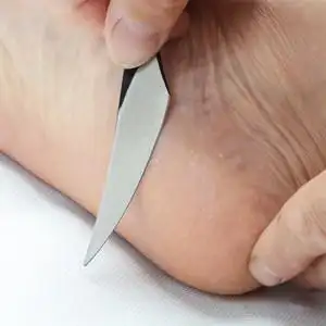 去死皮老茧三把刀图片】修脚刀套装去死皮老茧三把刀图片大全_q友网