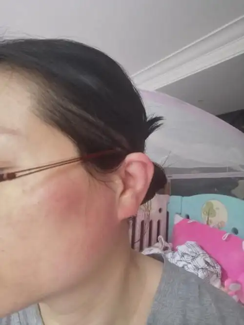 哺乳期发烧到底能不能喂奶