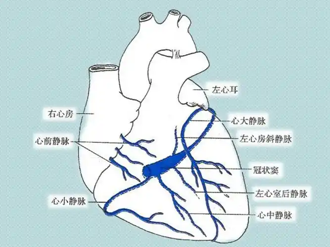 冠状静脉窦无顶综合征ppt课件