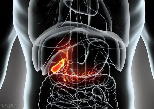 切胆还是保胆?微创保胆术后注意全在这里