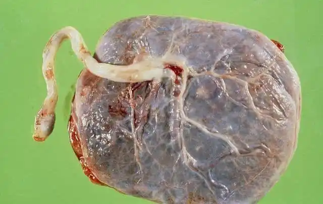 胎盘后,一般找一棵大树底下偷着埋了,说那样做是为了小婴儿的健康成长