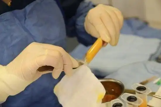 自体脂肪移植只适合胖人?瘦子能做吗?