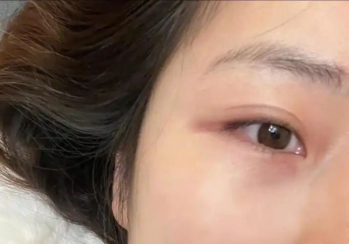 终于知道了眼尾沟的作用