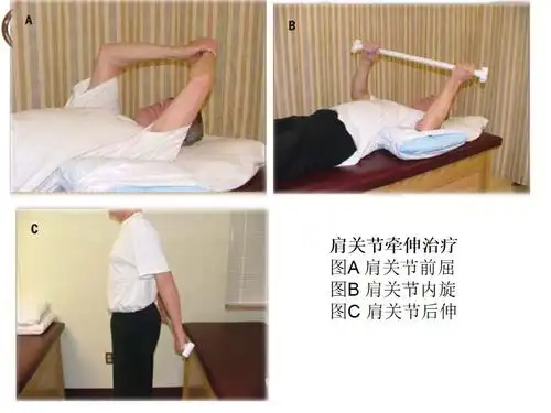 stage) 发病后约15-24个月,炎症逐渐消退,疼痛逐渐减轻,肩部粘连缓慢