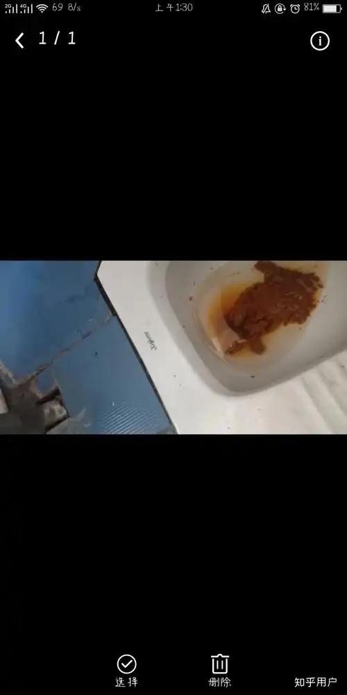 你有没有"放屁喷出屎"的经历? - 知乎