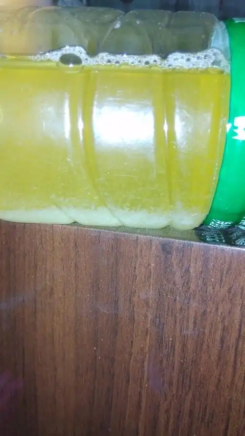 尿液沉淀有白色物