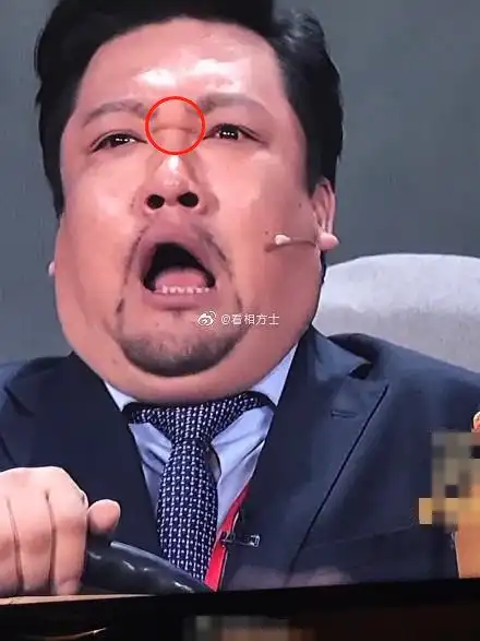 山根位于两眼之间鼻梁处,主一个人的婚姻及健康运势,也是青年到中年