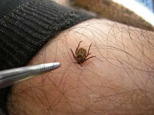 谈虎色变----蜱虫(草爬子) - 宁静致远 - 宁静致远