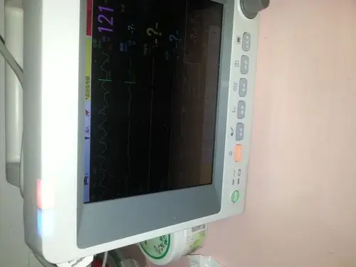 心电机械分离的心监照片分享一下!