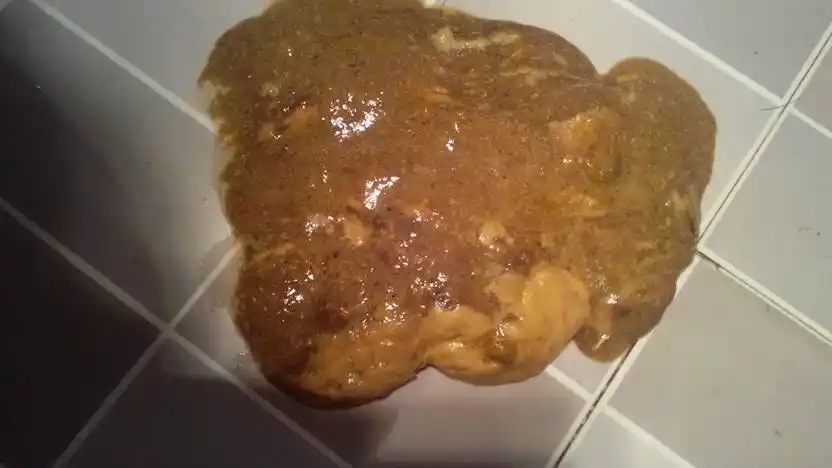 本来好了拉得也干了可是后来感冒去佳木斯赵宏那开的肠炎和感冒药 吃