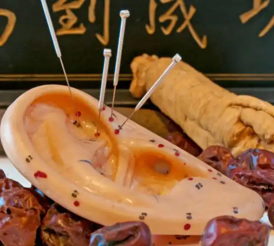 特色中医药疗法耳针