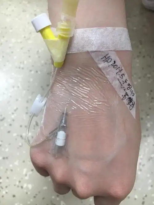 静脉留置针的正确固定方法!