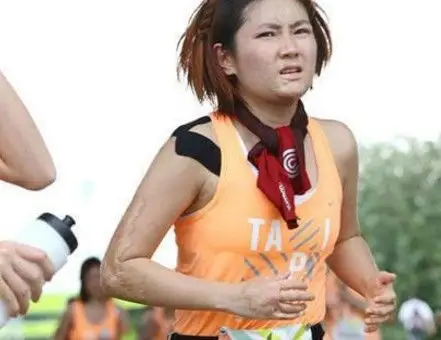 【图】任家萱烧伤后素颜照曝光 康复后脸上仍留下伤疤