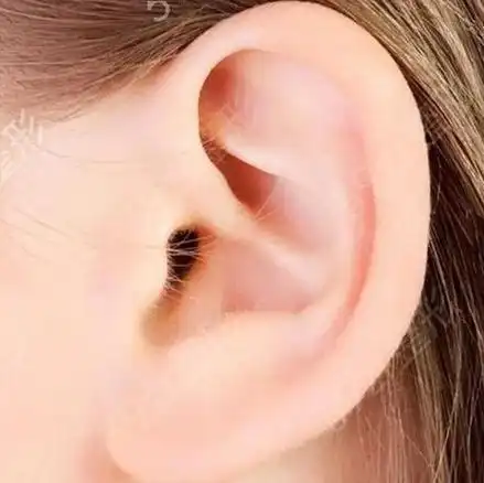 5,玻尿酸填充耳垂能维持多久?玻尿酸丰耳垂可以持续大约6-12个月.