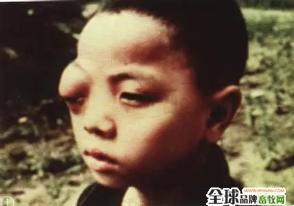 猪旋毛虫病--人畜共患病