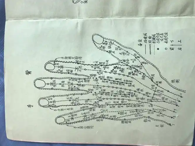 其它 手针简史 写美篇三十年来从1982年朱振华的