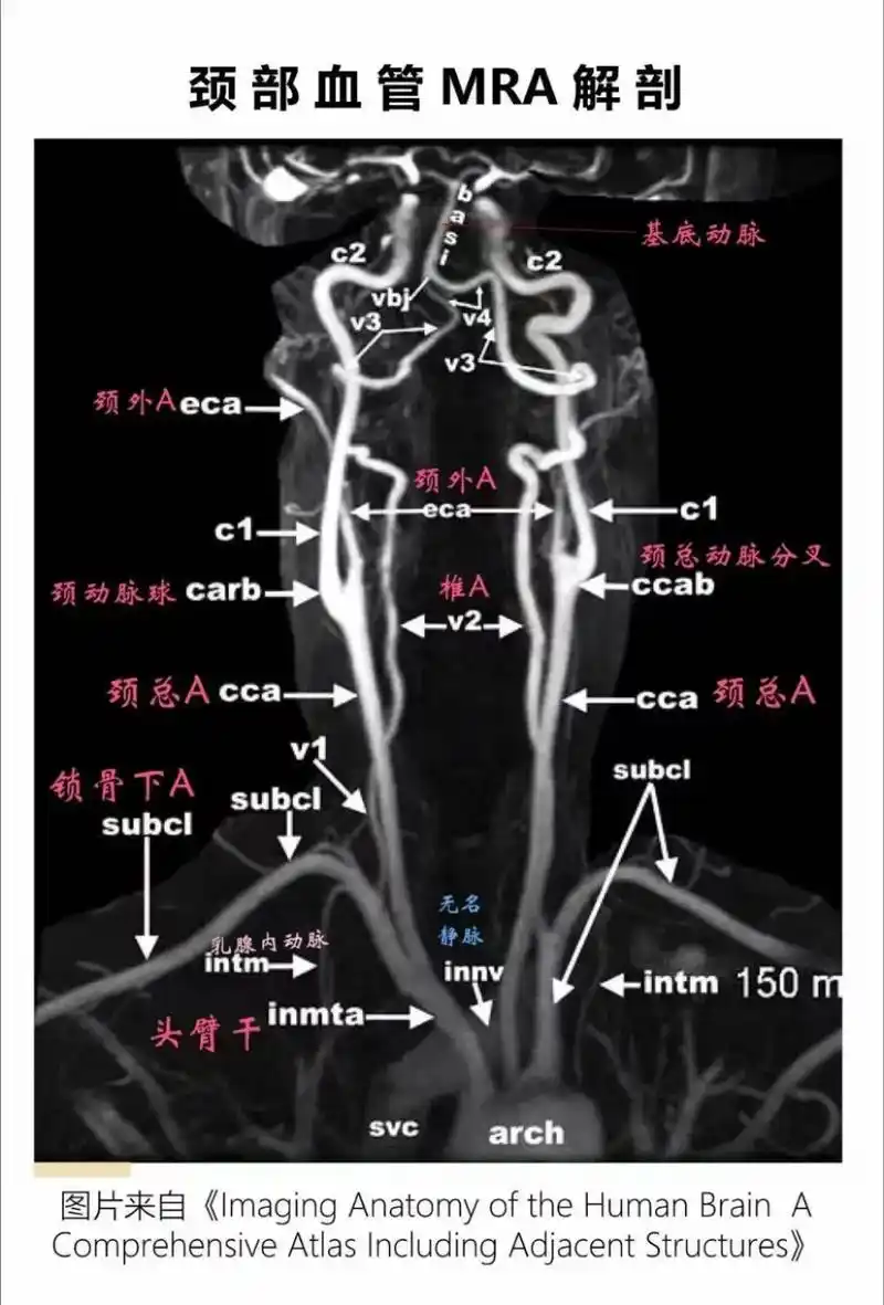 医学影像 #医学科普 #颈动脉 #解剖 #每天跟我涨知识 - 抖音