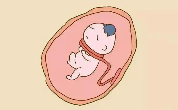 胎儿脐带绕颈能不能顺产 - 绕颈一周矫正方法 - 注意事项 - 相因