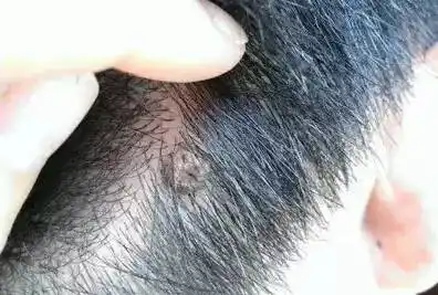 忘记和理发师交代,结果理发师一刀就把自己头发里长的"福痣"剃破了,没