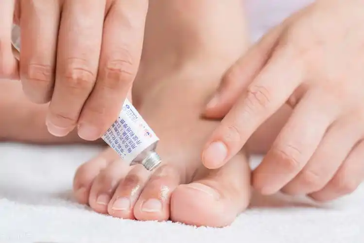 氟康唑多少钱一盒7块钱酮康唑乳膏很实用