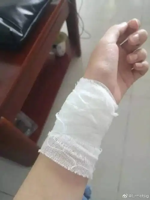 事发济南!大学女生留遗言割腕自杀!网友称辅导员差点逼死同学!