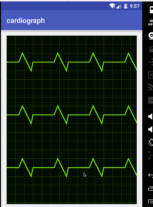 心电图效果viewandroid自定义view