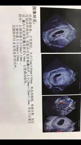 6一7周孕囊大小看男女