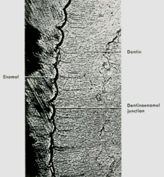 2018口腔组织病理学考点:牙釉质的组织学结构