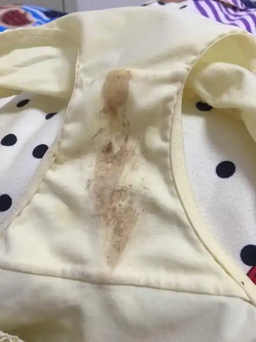 褐色分泌物有图