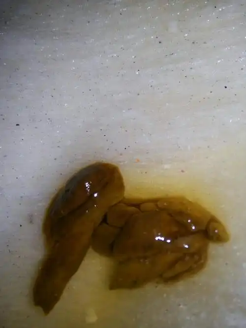 这样大便颜色形状正常吗