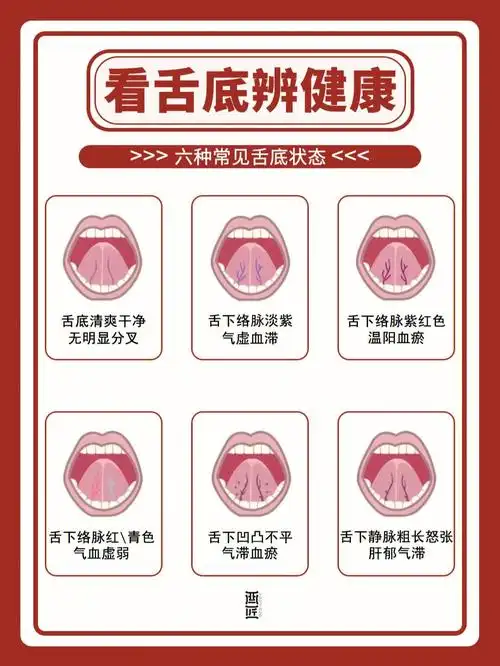 98看舌底辨健康舌下青筋什么样是正常的?