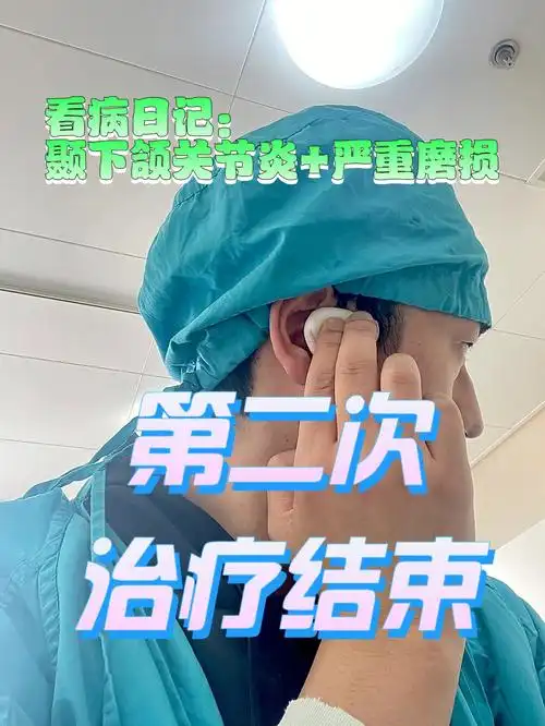 第二次治疗结束颞下颌关节炎不可复磨损