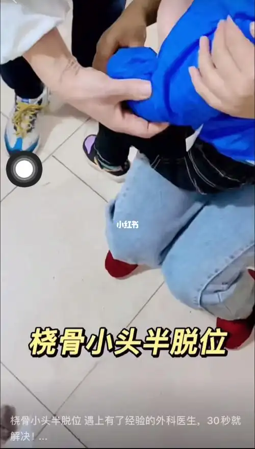 手法复位桡骨小头脱位