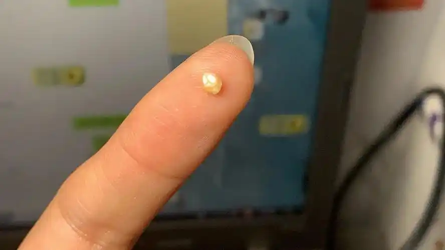 眼里掉出一颗珍珠我被闺蜜们敬为蚌精大人