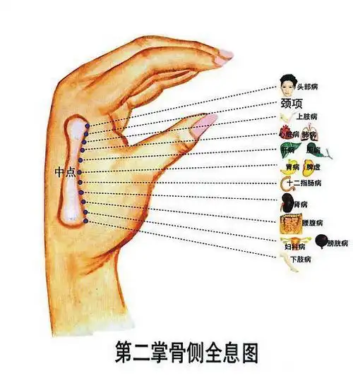 6第二掌骨全息图(侧).jpg