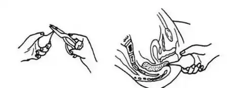 开塞露大人怎么用图解,大人开塞露用多少毫升