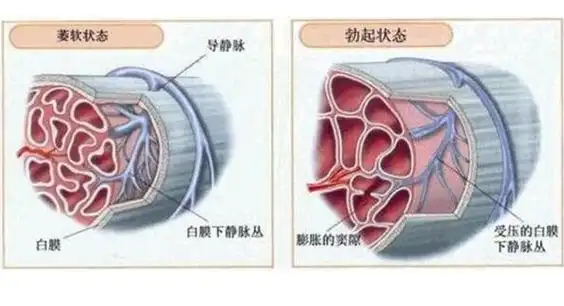 恢复海绵体最好的办法,折断必须手术平常一定要注意食补