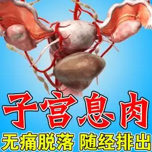 子宫内膜增厚调理图片