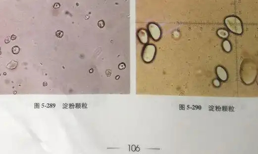 《实用尿液有形成分图鉴》[3]再对比一下图谱上的淀粉颗粒,是不是跟