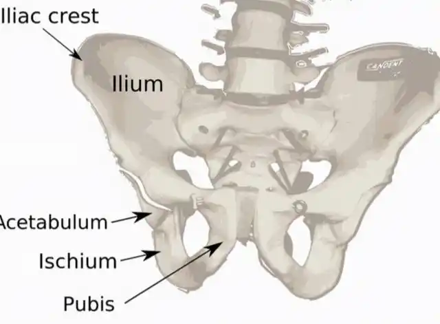 类人猿型骨盆,常见症状为骨盆形态异常,部分可能会有遗传倾向
