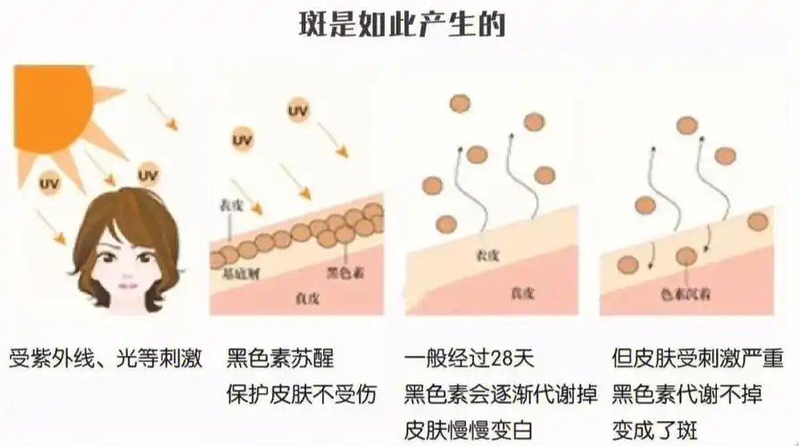 和色素沉着会影响美观以及我们的身体健康,那么当黑色素沉着的时候