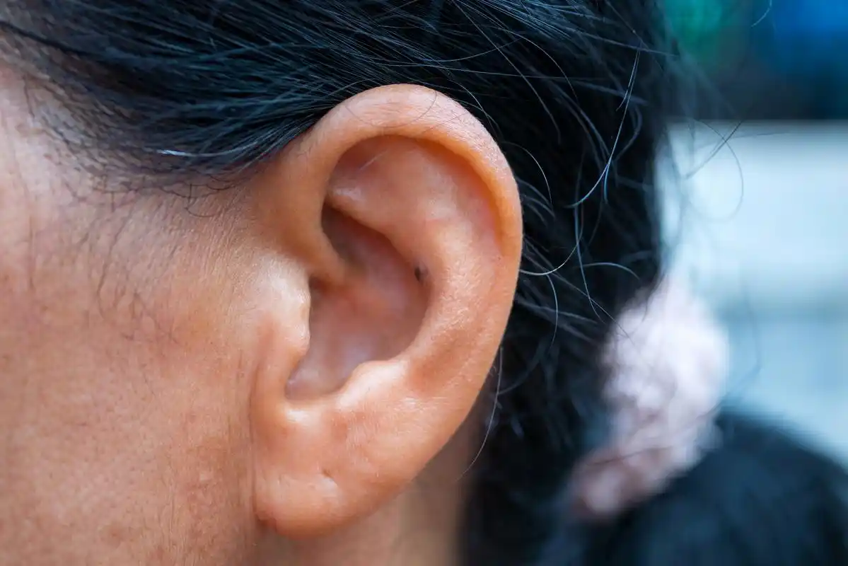 贴面耳好还是招风耳好  贴面耳和招风耳都是耳廓畸形的一种,在医学上