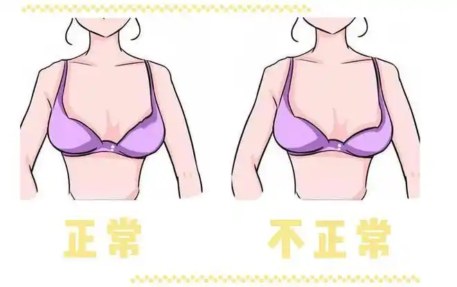 研究表明,光胸部大小都有44%的女性觉得自己的左右不一致,更别提乳头