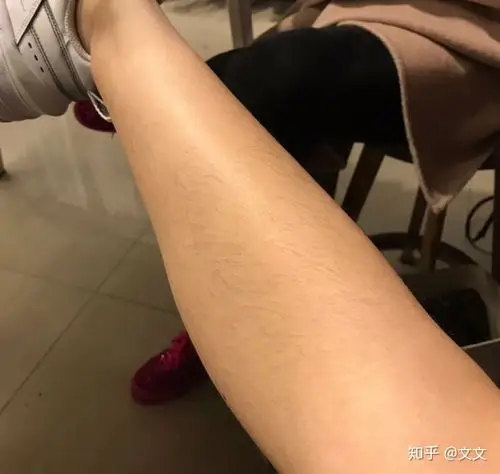 想知道女生脱毛有没有某个时间点是最有效果的呢1个月中有最佳脱毛