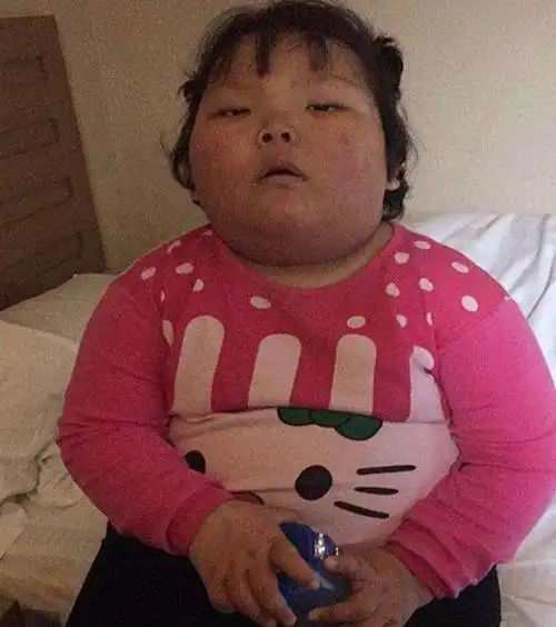 半年之后,多多妈发现多多胖了好多,体重几乎是其他正常小朋友的两倍