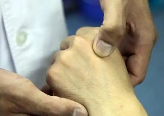 【功能主治】 落枕,颈椎病,牙痛,五谷不消,腹痛泄泻,小儿脐风,掌指